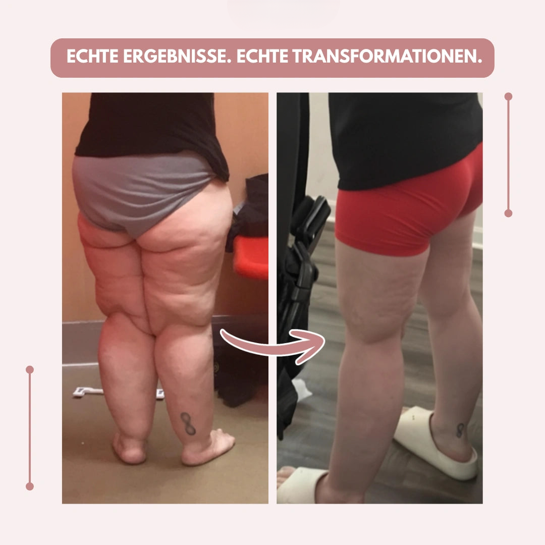 Srovnání před a po: žena zezadu ve spodním prádle a poté v červených krátkých kalhotkách, nohy působí hladší. 10