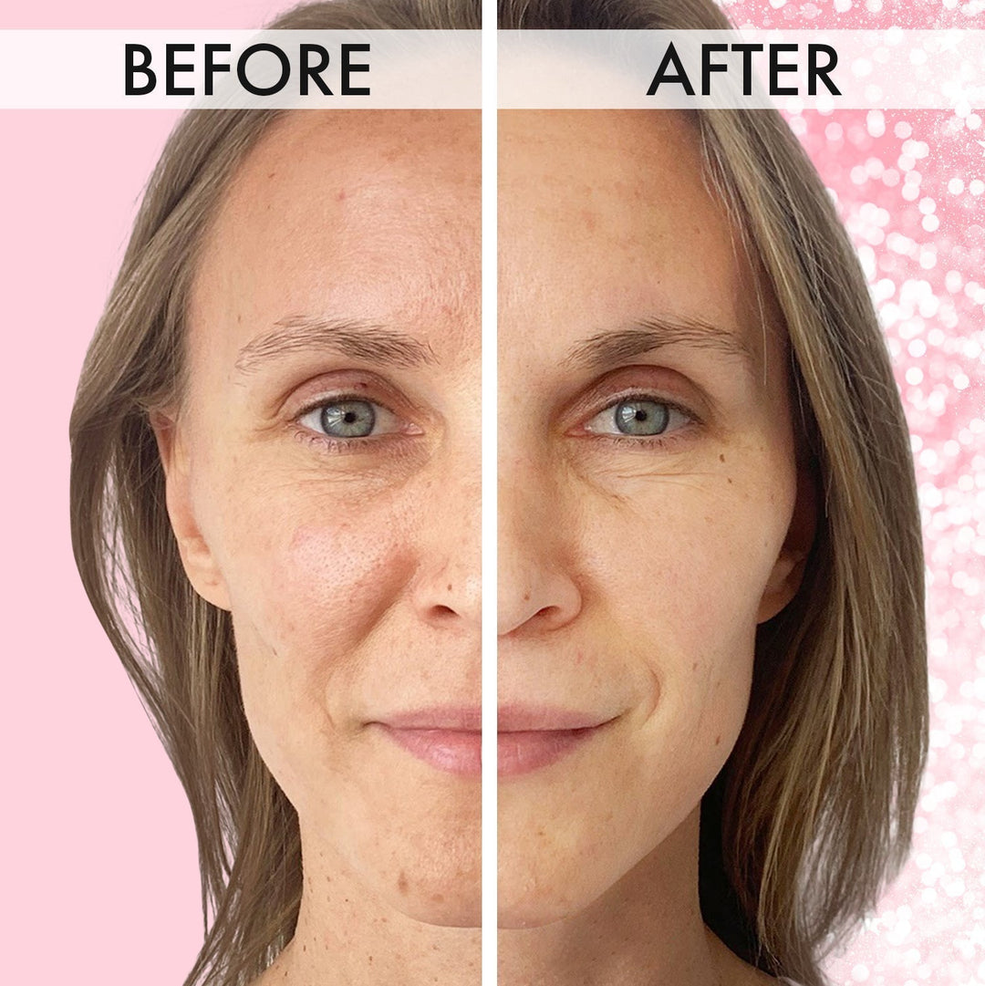 Vorher-Nachher-Bild einer Frau, Hautpflege-Ergebnis, glattere Haut, Anti-Aging-Effekt.
