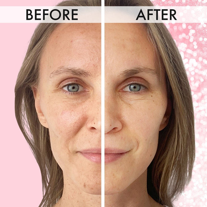 Vorher-Nachher-Bild einer Frau, Hautpflege-Ergebnis, glattere Haut, Anti-Aging-Effekt.