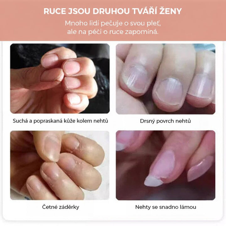 Čtyři snímky problémů rukou: suché okraje nehtů, drsný povrch, záděry a lámavé nehty 3