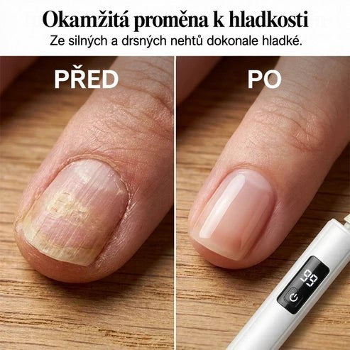 Srovnání nehtu před úpravou, drsného a žlutavého, a po úpravě, hladkého a růžového 4