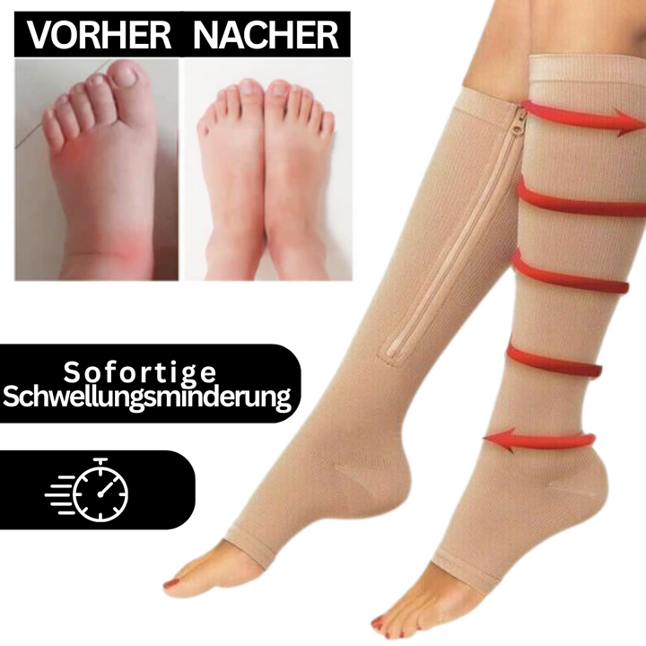 Beige Kompressionsstrümpfe mit Reißverschluss zur Schwellungsreduktion, Vorher-Nachher-Vergleich.