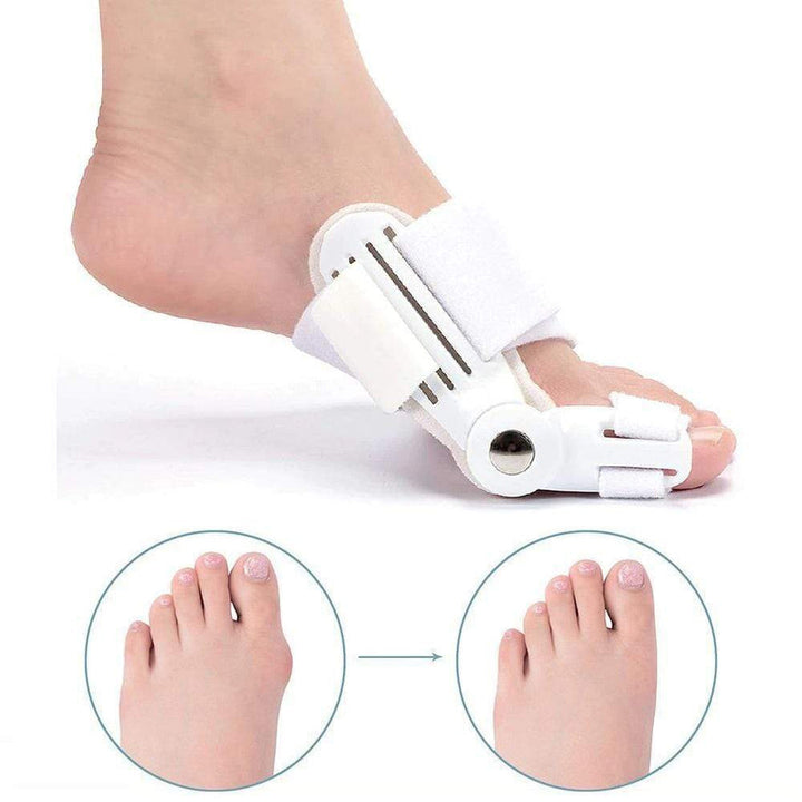 Orthopädischer Hallux-Valgus-Korrektor, weiß, Fußkorrektur, Schiene zur Schmerzlinderung.